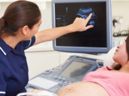 From which week could you hear your baby's heartbeat?