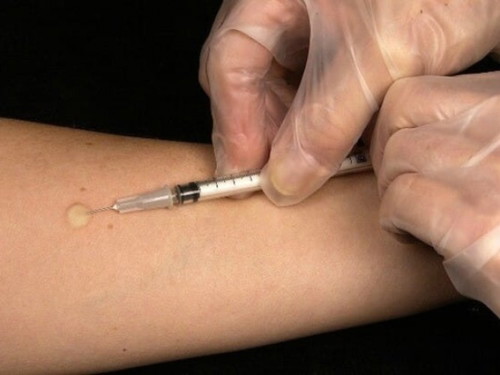 When did you get the rubella vaccine?