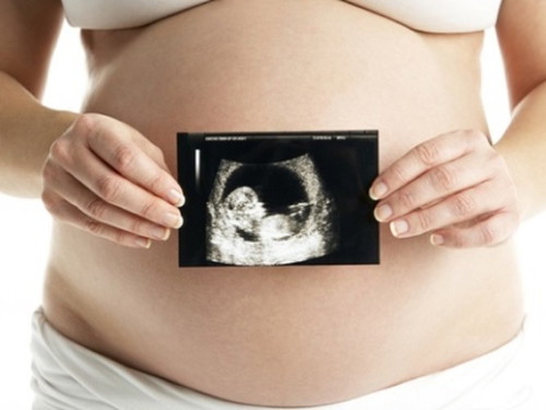 Would you show your child his or her sonogram photos when they will grow up?