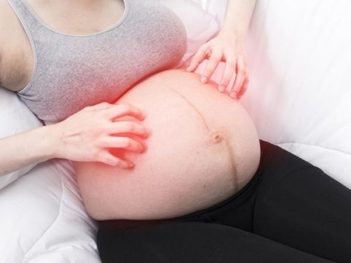 Itching During Pregnancy