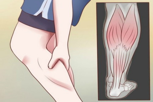 What can you do to prevent leg cramps during pregnancy ?