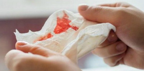 Pernahkah anda alami pendarahan ketika hamil?