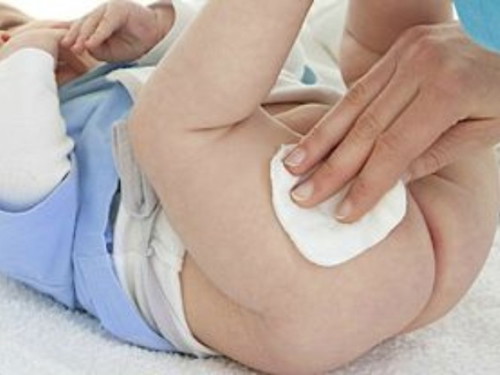 Do you apply diaper cream at every change?