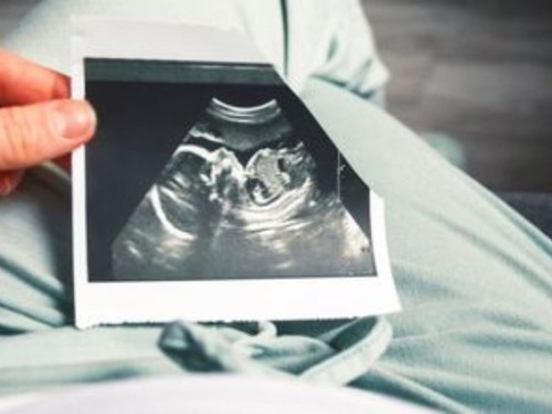 Can you guess the baby gender by their heart rate during pregnancy?