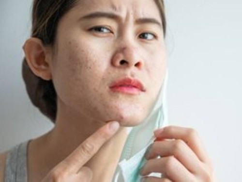 What kind of skin problems do you have?