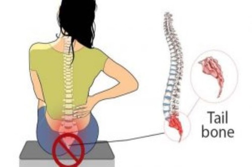 Ibu, adakah anda kerap kali sakit di tulang ekor selepas kehamilan anda?