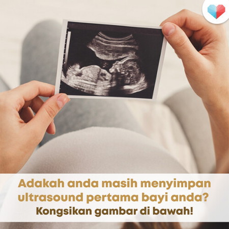 Gambar Ultrasound Pertama Anda!