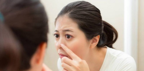 Cek di <a href='https://id.theasianparent.com/serum-untuk-bekas-jerawat' target='_blank' >https://id.theasianparent.com/serum-untuk-bekas-jerawat</a> untuk tau rekomendasi produknya.