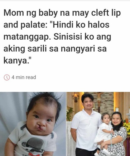 Basahin ang kuwento at struggle ng isang Mommy sa pagtanggap ng realidad na ito: <a href='https://ph.theasianparent.com/cleft-palate-story' target='_blank' >https://ph.theasianparent.com/cleft-palate-story</a>