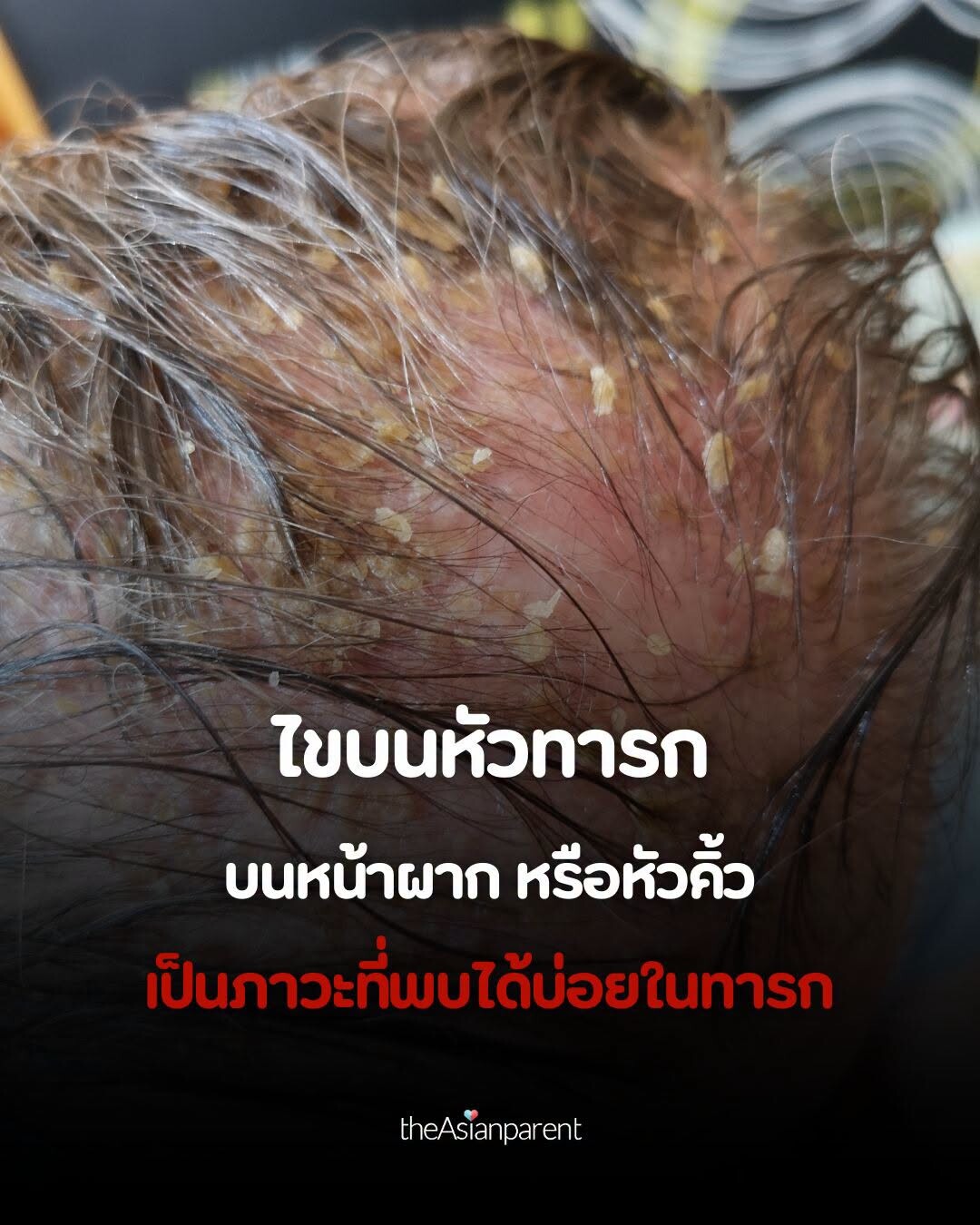 article-image
