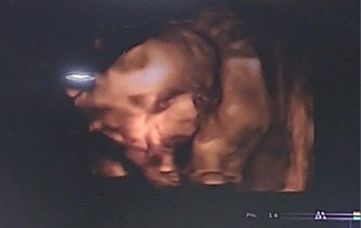 Kaewsamai Phondii profile icon