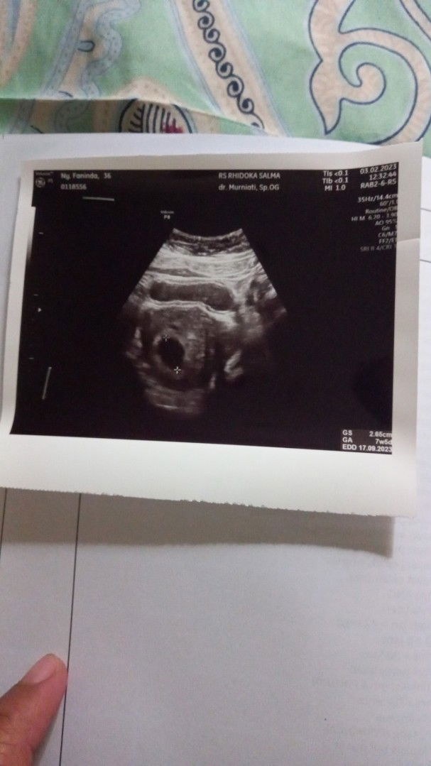 Fanida Letsoin profile icon