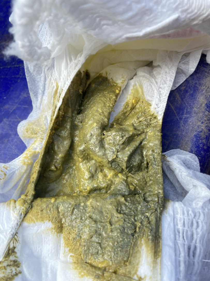 อุจจาระสีเทา