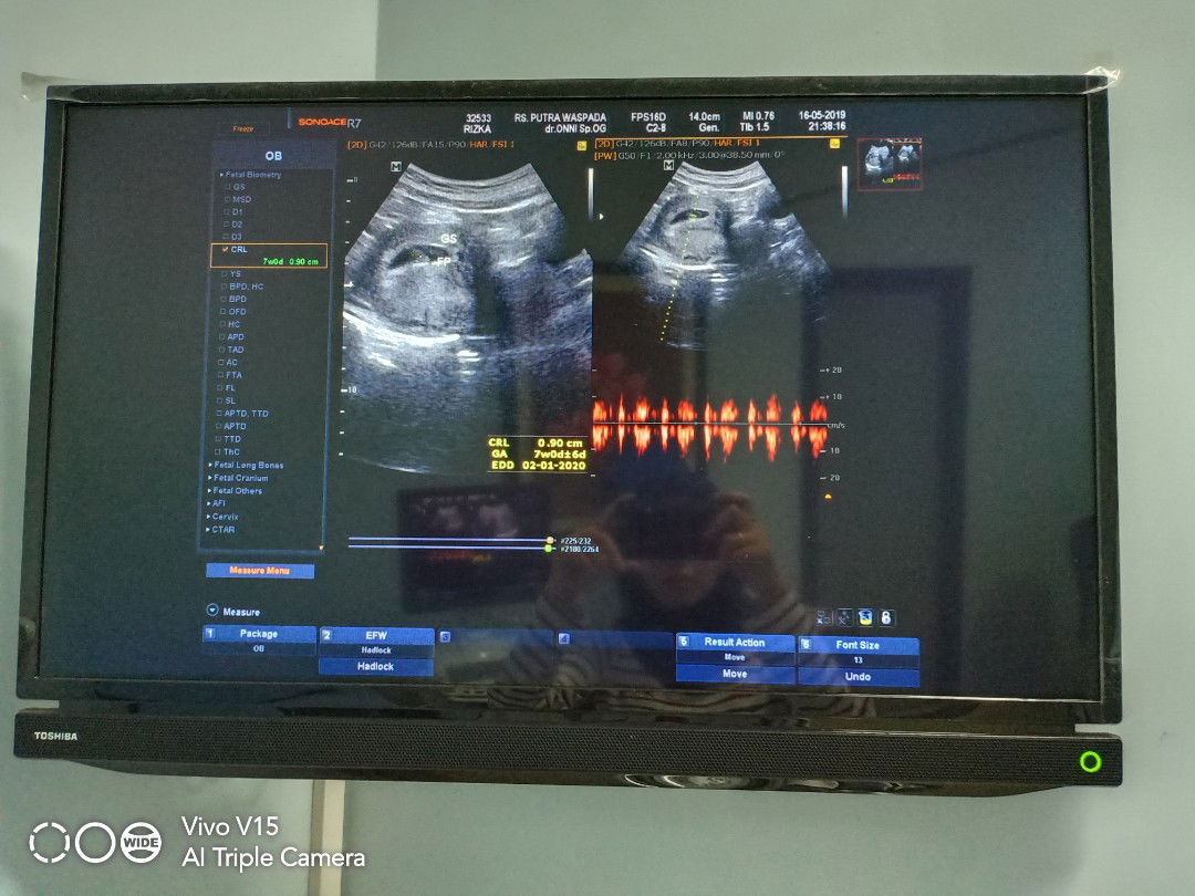 Rizka Milla profile icon