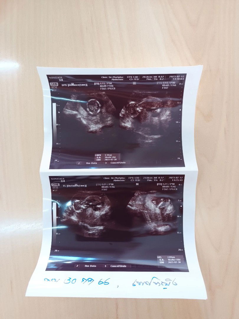 ณัฐ profile icon