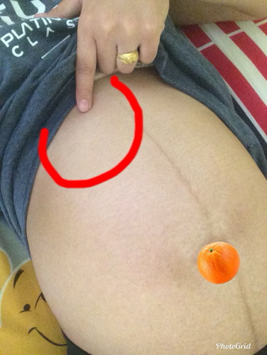 เจ็บตรงที่วงกลม