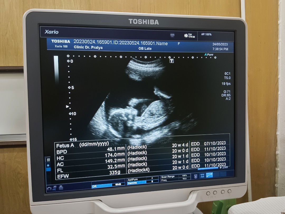 นู๋ แอน profile icon