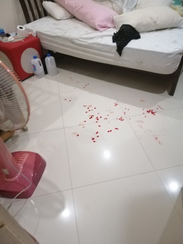 30 Week เลือดออกเยอะมาก แต่ไม่ปวดท้อง