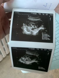 Supansa Kwangthu profile icon