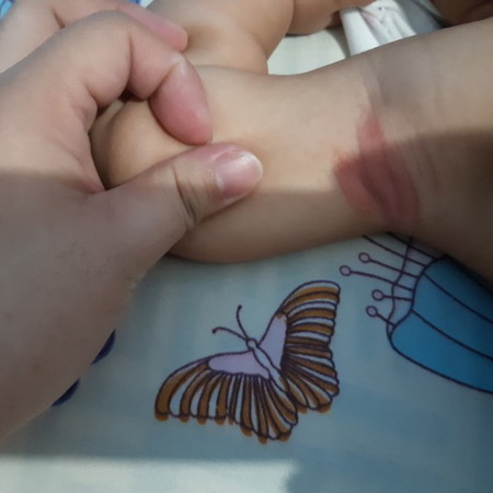 namumulang kilikili ni baby