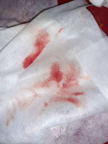 Blood.