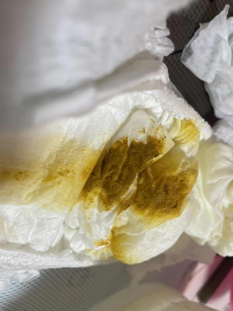 Bé nhà em 6m18d 10 hôm mới đi nặng phân này có ổn ko ạ. Bé ăn dặm và bú mẹ