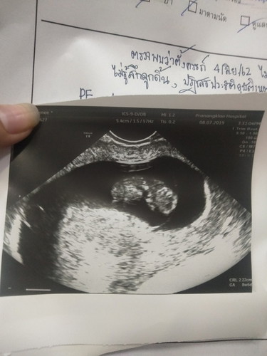 17วีค