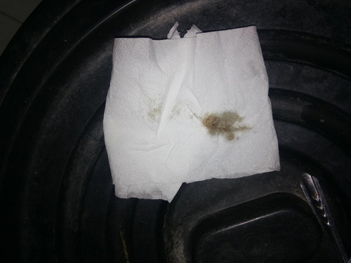 ตกขาวสีน้ำตาล ไม่มีกลิ่น แต่ปวดหน่วงท้องเป็นระยะ