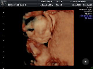 คิม profile icon