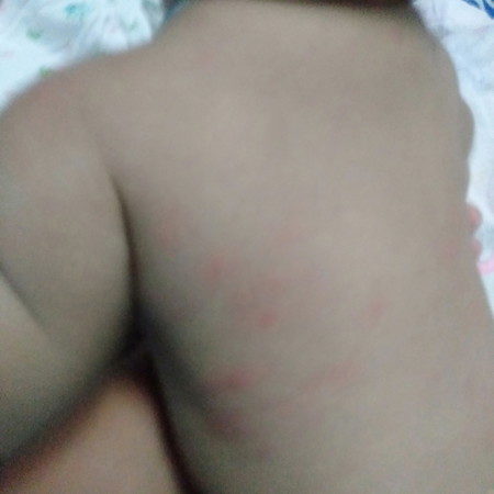 แพ้อะไร