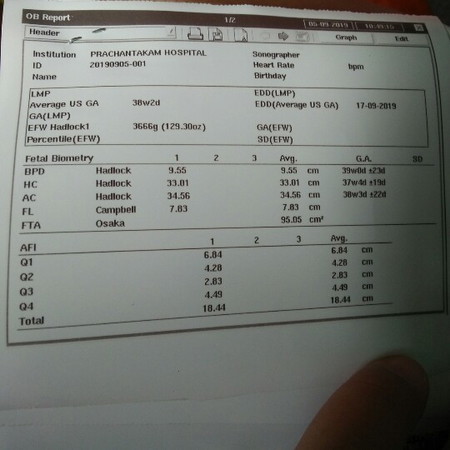 คุณแม่ท่านไหนทราบบ้าง