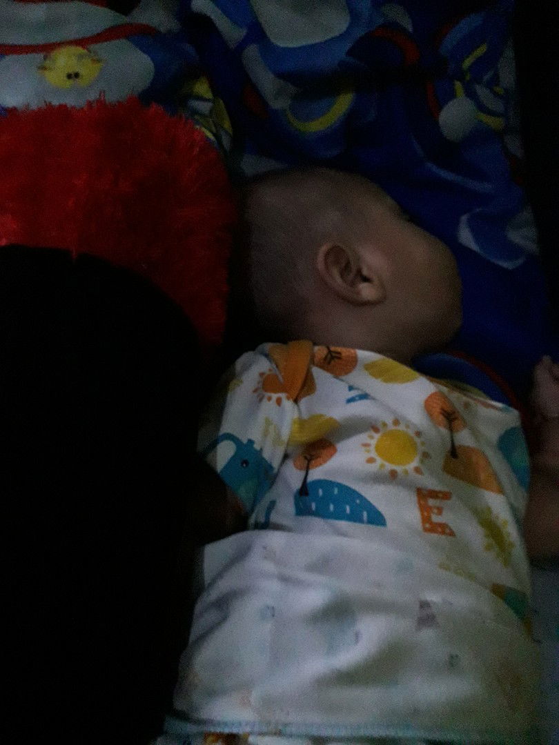 bercak putih pada kulit bayi