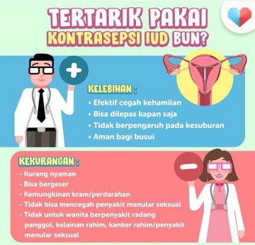rasanya waktu pasang IUD gimana ???
