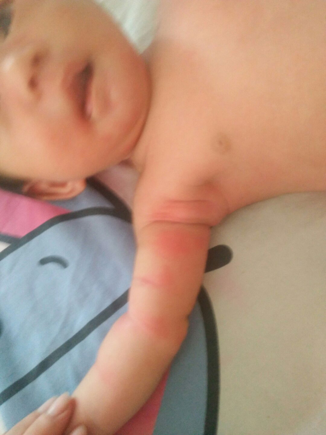 แดงตามตัวว