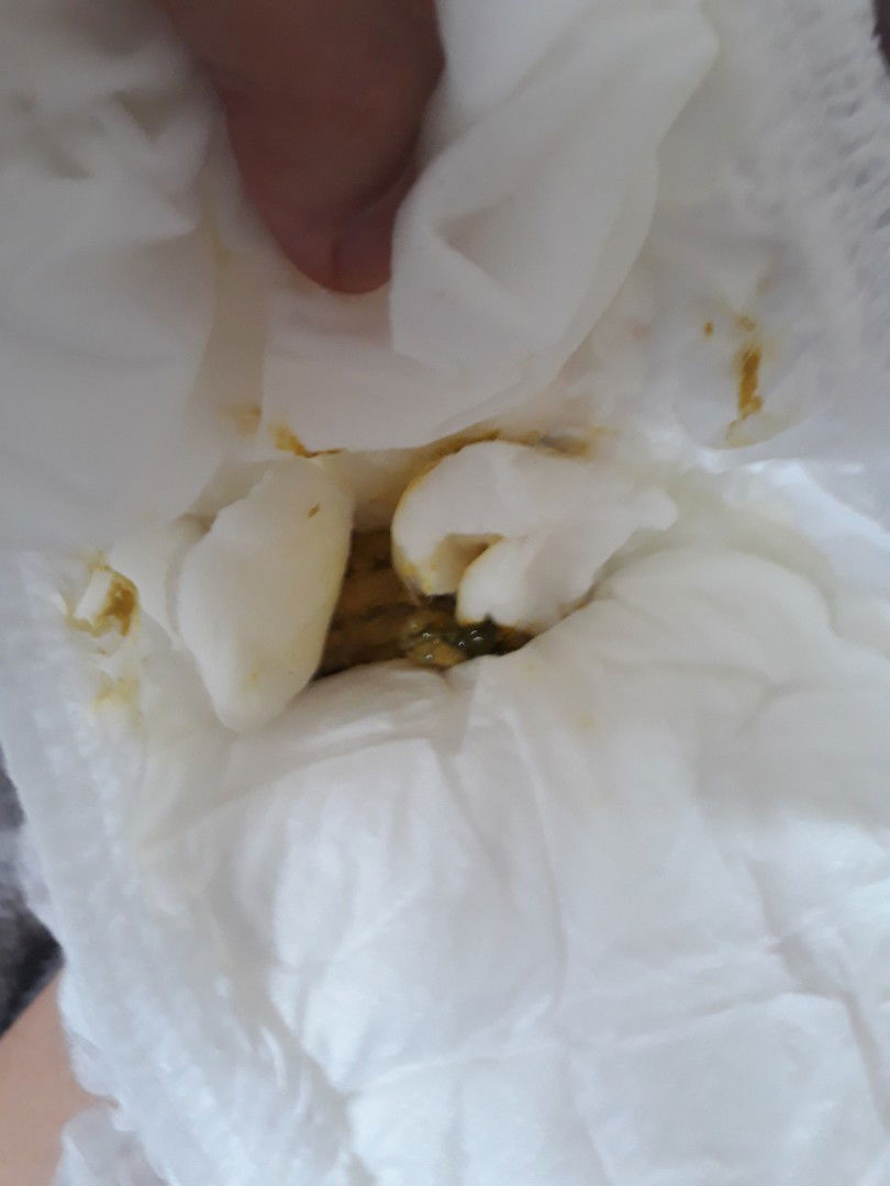 ลูกอึสีแปลกๆ