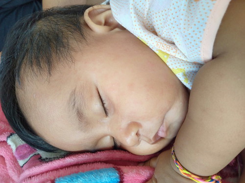 ผื่นขึ้นที่ตัวลูกค่ะ