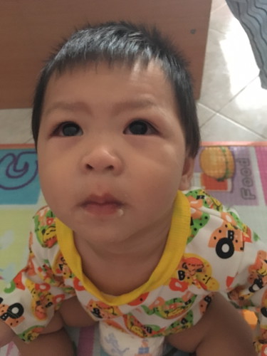 ลูกชายล้มกระแทกโต๊ะ