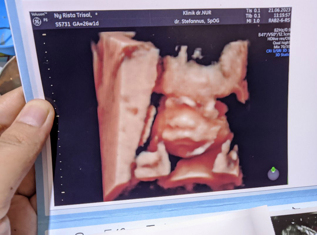 Rista Gita profile icon