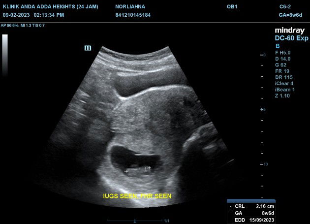 Nana Lin II profile icon