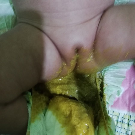 Nagtatae Po Ba Baby Ko?