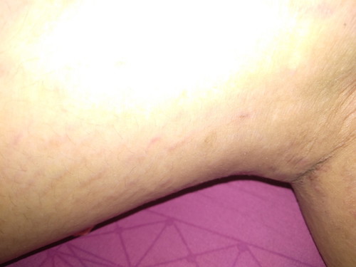 strec mark