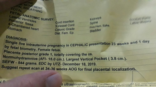 pinarepeat ultrasound ko..bkit po.kaya..