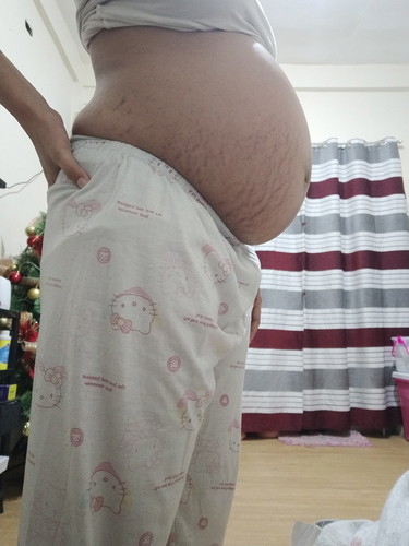 Going to 36 weeks