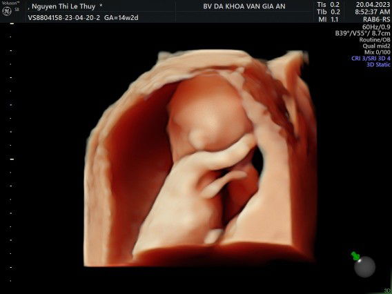 Lệ Thủy profile icon