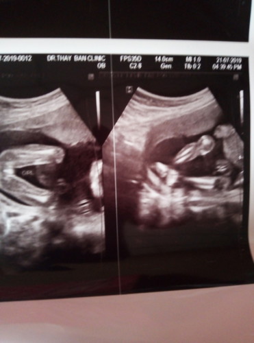 ลูกสาว