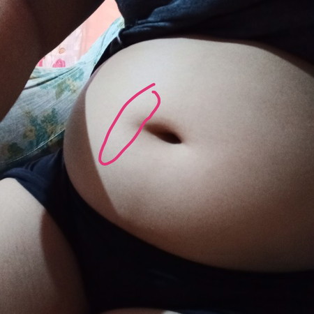 ' Dont know if Normal ?