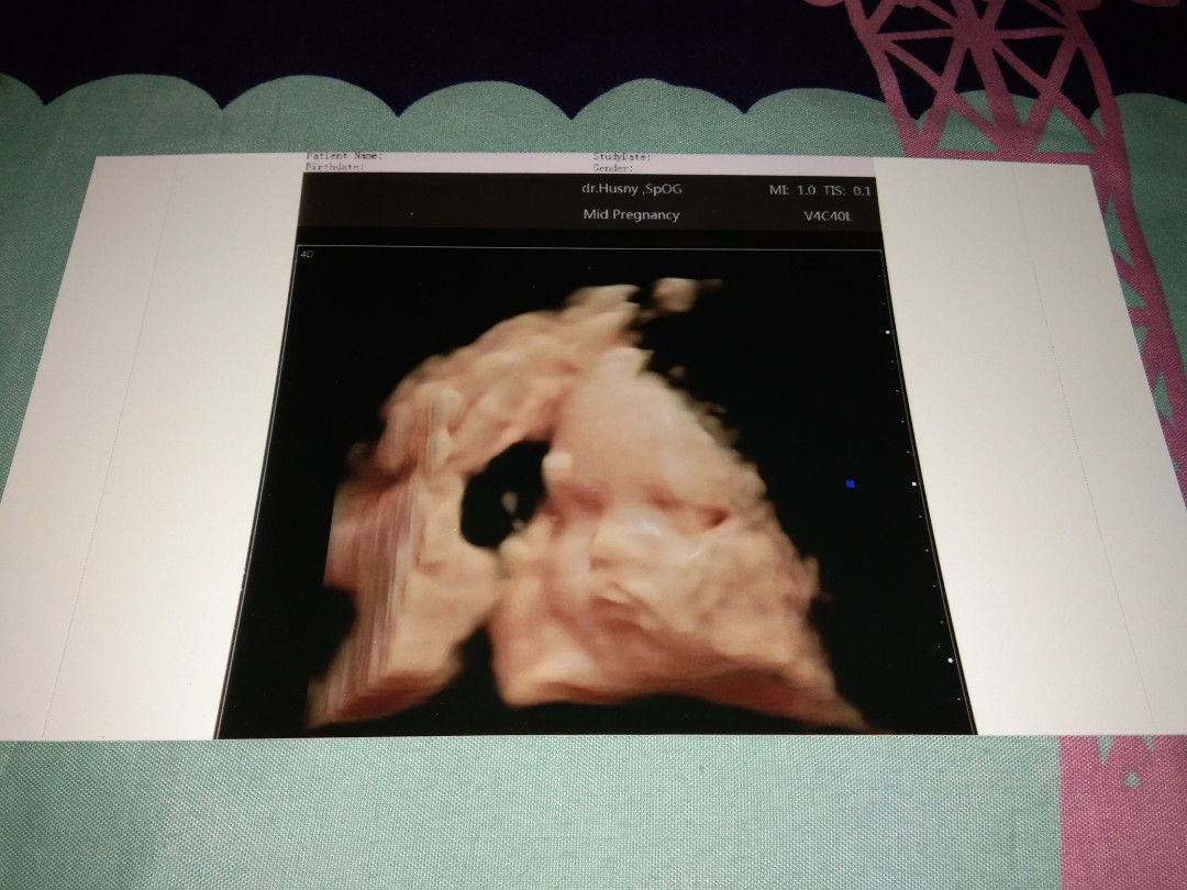 adakah yang sepengalaman