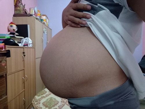 amniotic fluid