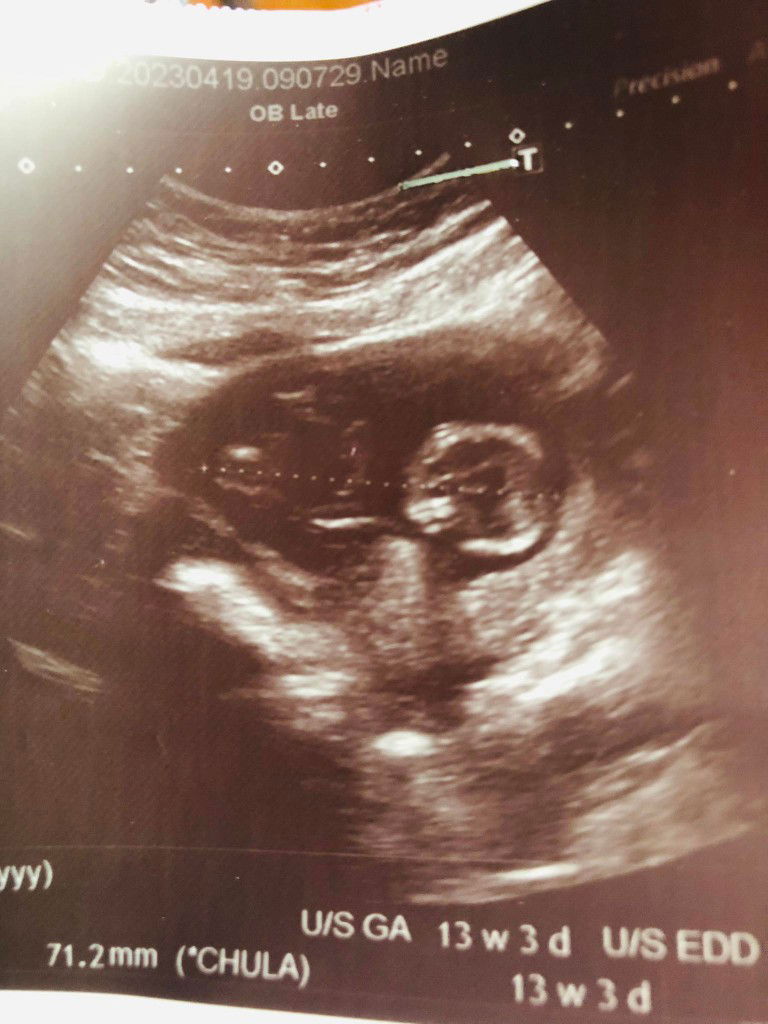 Chonthicha Intasaro profile icon