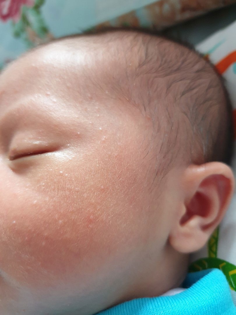 bintik2 kayak keringet malam